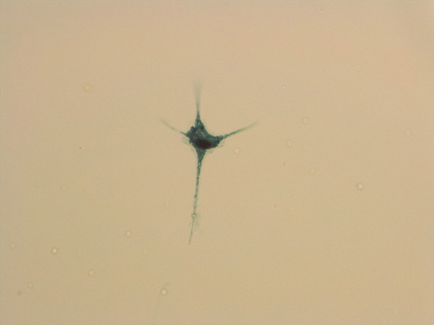 Ceratium Slides - Ceratium 06 200X